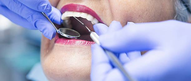 Dentist for Dental Trauma in MD